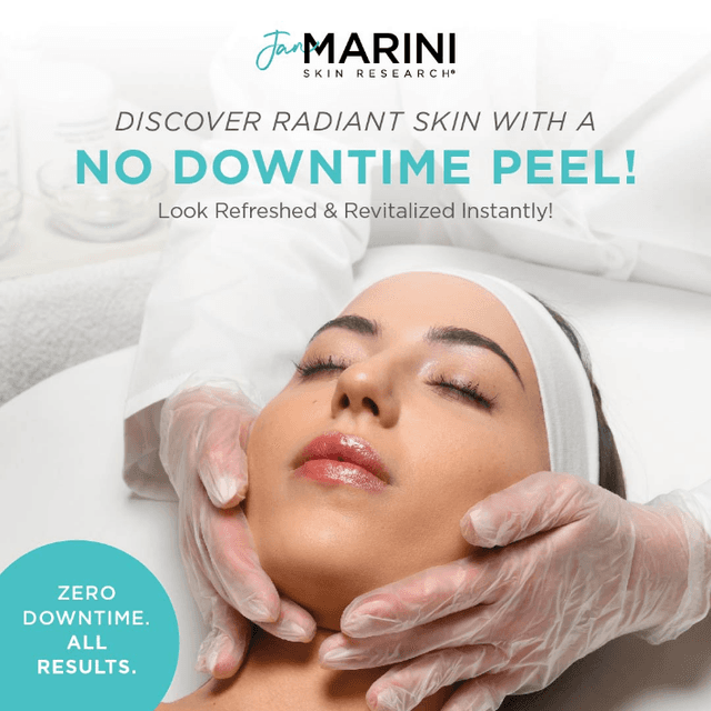 3 Glycolic No Downtime Peels at Candice Marie Esthetics in Yardley, PA